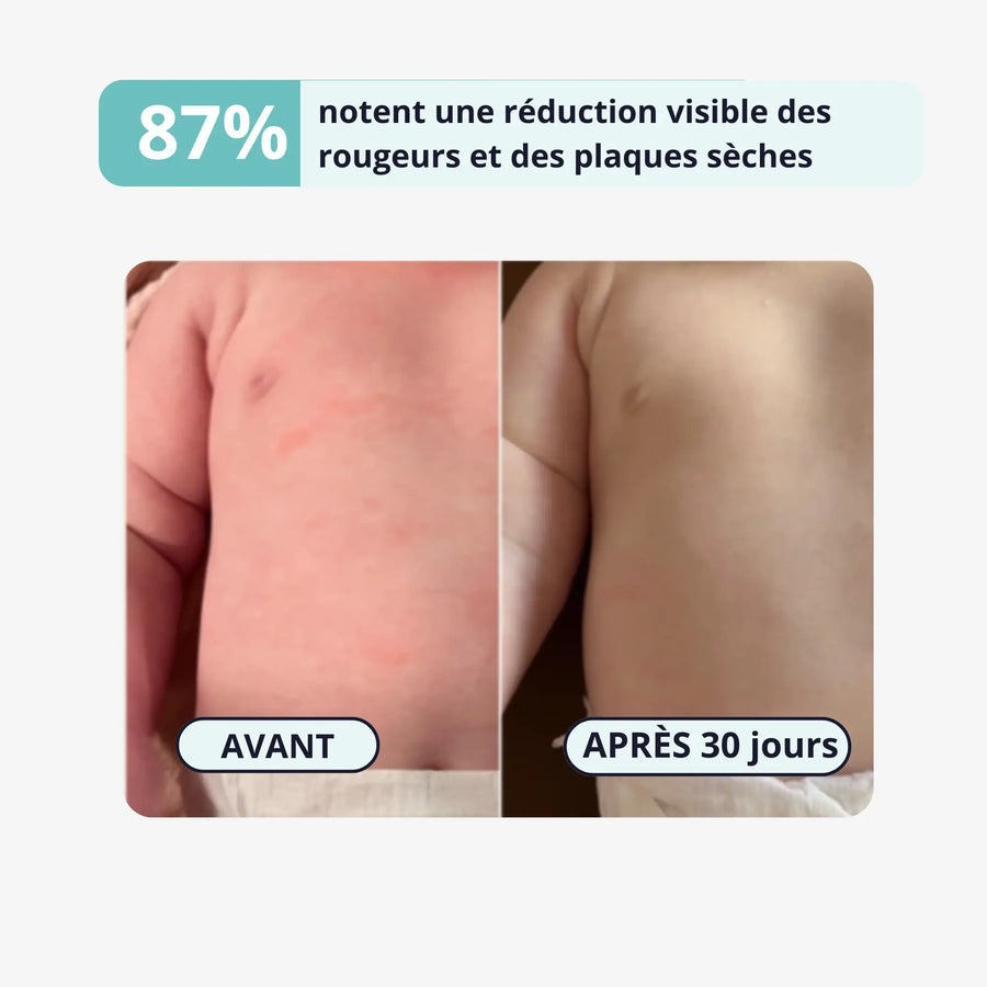 Filtre Pur OROBY